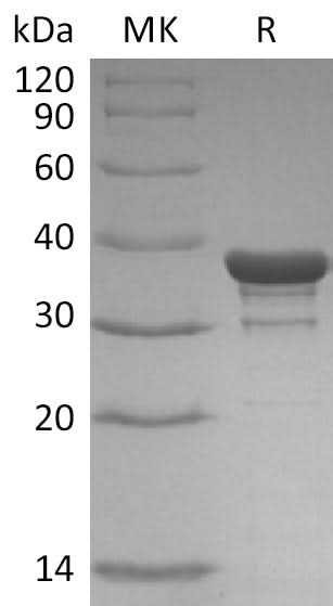 Recombinant SARS-CoV-2 NP (Truncated) (His Tag) - ABMIUM