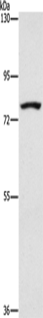 Anti-Human SENP1 Antibody - ABMIUM