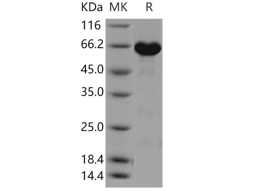 Recombinant Human ERK3/MAPK12 Protein (His & GST Tag) - ABMIUM