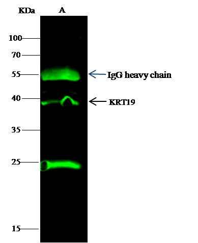 Anti-Human KRT19 Antibody [A1010] - ABMIUM