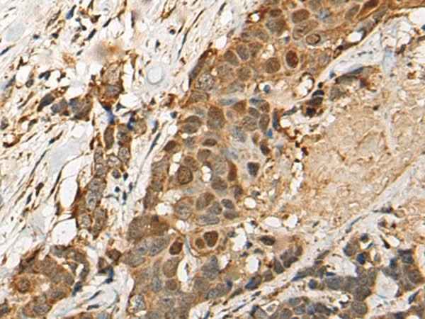 Anti-Human HEATR9 Antibody