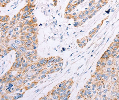 Anti-Human/Mouse/Rat GFRA3 Antibody - ABMIUM