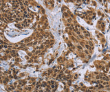 Anti-Human CCL21 Antibody - ABMIUM