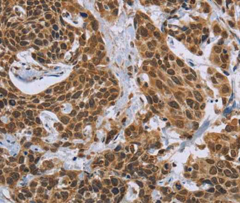 Anti-Human CCL21 Antibody