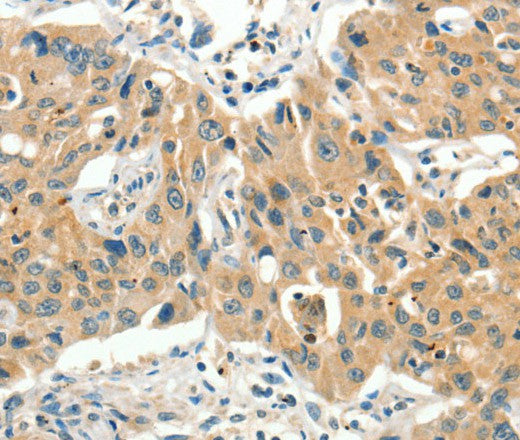 Anti-Human/Mouse/Rat SLC11A2 Antibody - ABMIUM
