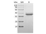 Recombinant Human Chymotrypsin C Protein (His Tag) - ABMIUM