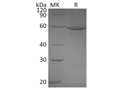 Recombinant Human ALDH3A1 Protein (Human Cells, His Tag) - ABMIUM