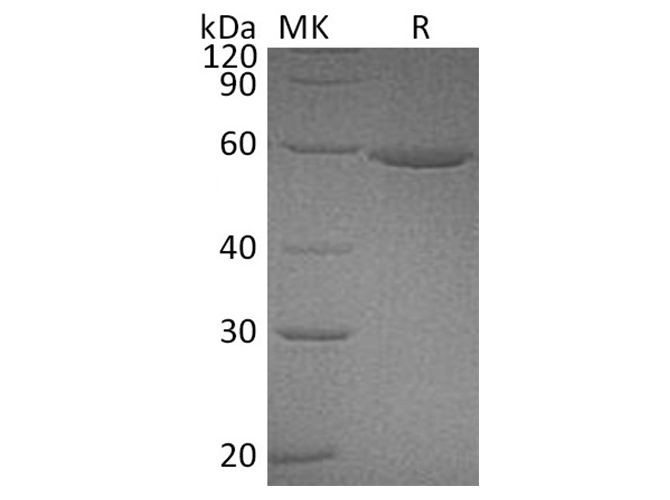 Recombinant Human ALDH3A1 Protein (Human Cells, His Tag) - ABMIUM