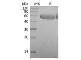 Recombinant Macaca mulatta AHSG/Fetuin A Protein (His Tag) - ABMIUM