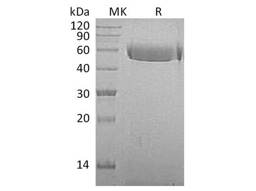 Recombinant Macaca mulatta AHSG/Fetuin A Protein (His Tag) - ABMIUM