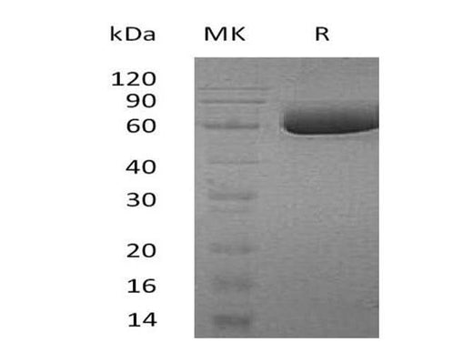 Recombinant Human SMPDL3A Protein (His Tag) - ABMIUM