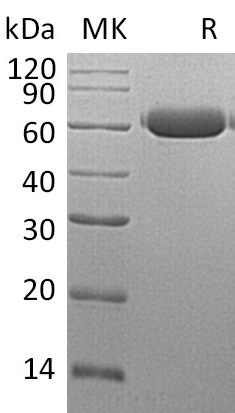 Recombinant Mouse Legumain/LGMN Protein (His Tag) - ABMIUM