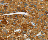 Anti-Human SPARCL1 Antibody - ABMIUM