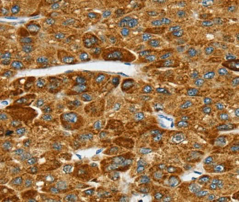 Anti-Human SPARCL1 Antibody - ABMIUM