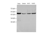 Anti-Human/Mouse/Rat CK Antibody - ABMIUM