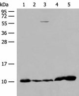 Western blot analysis of 293T cell Human fetal liver tissue Human heart tissue lysates using ATP5I Polyclonal Antibody at dilution of 1:200