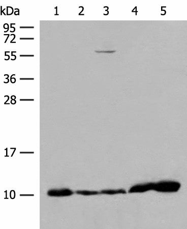 Western blot analysis of 293T cell Human fetal liver tissue Human heart tissue lysates using ATP5I Polyclonal Antibody at dilution of 1:200