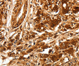 Anti-Human/Mouse/Rat TGFBR1 Antibody - ABMIUM