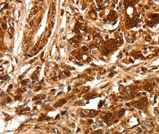 Anti-Human/Mouse/Rat TGFBR1 Antibody - ABMIUM