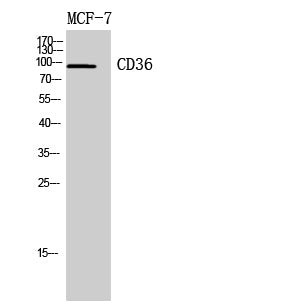 Western Blot analysis of MCF7, 4T1 cells with CD36 Polyclonal Antibody.