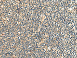 Immunohistochemistry of paraffin-embedded Human tonsil tissue using PRKRA Polyclonal Antibody at dilution of 1:60(×200)