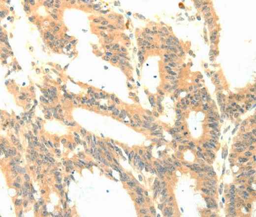 Anti-Human/Mouse/Rat PTGES3 Antibody