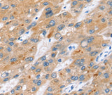 Anti-Human ERVW-1 Antibody - ABMIUM
