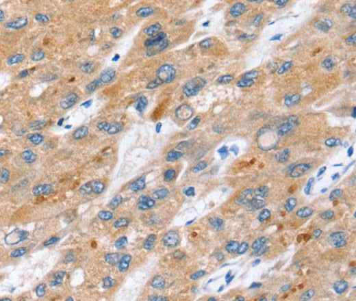 Anti-Human ERVW-1 Antibody