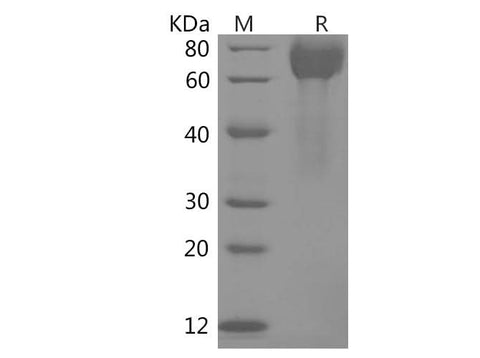 SDS-PAGE analysis of Human B7-H3/CD276 proteins, 2 μg/lane of Recombinant Human B7-H3/CD276 proteins was resolved with SDS-PAGE under reducing conditions, showing bands at 60-80 kDa.
