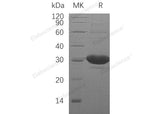 Recombinant Human DCXR Protein (His Tag) - ABMIUM