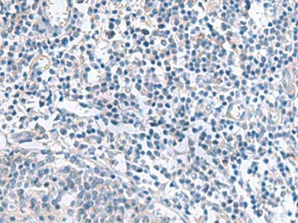 Anti-Human/Mouse/Rat MYL1 Antibody