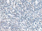 Immunohistochemistry of paraffin-embedded Human tonsil tissue using MYL1 Polyclonal Antibody at dilution of 1:50(×200)