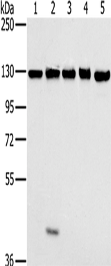 Anti-Human/Mouse MATR3 Antibody - ABMIUM