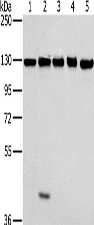 Anti-Human/Mouse MATR3 Antibody - ABMIUM