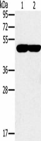 Anti-Human/Mouse PPOX Antibody - ABMIUM