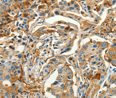 Anti-Human CALCA Antibody - ABMIUM