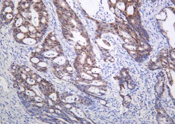 Anti-Human/Mouse/Rat CDX2 Antibody [B1009] - ABMIUM