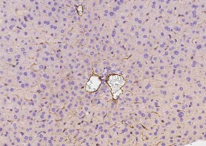 Anti-Mouse MCAM Antibody [B490] - ABMIUM