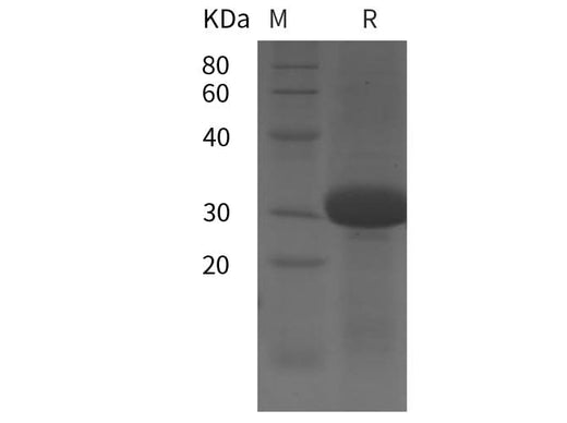 SDS-PAGE analysis of Human INHB proteins, 2 μg/lane of Recombinant Human INHB proteins was resolved with SDS-PAGE under reducing conditions, showing bands at 31 kDa.