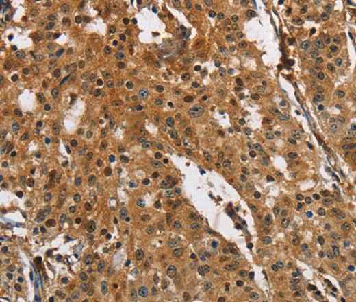 Anti-Human/Mouse PTK6 Antibody