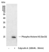 Anti-Human HIST1H3A Antibody [B290]
