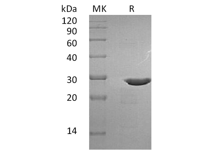 Recombinant Human BDNF Protein (with pro peptide) - ABMIUM