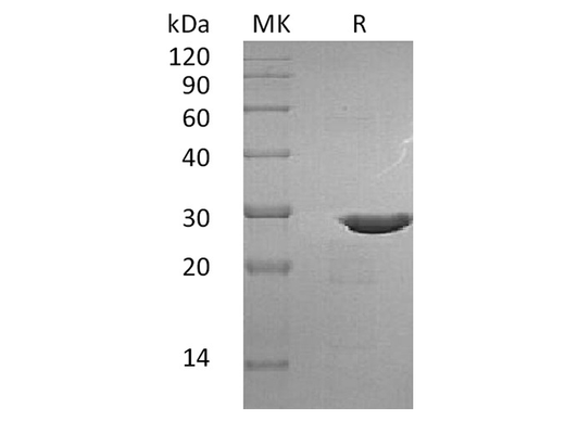 Recombinant Human BDNF Protein (with pro peptide) - ABMIUM