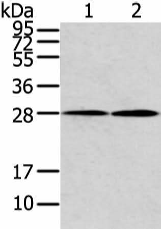 Anti-Human/Mouse KCNMB1 Antibody - ABMIUM
