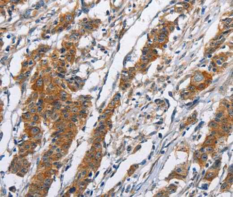 Anti-Human NCAPD3 Antibody