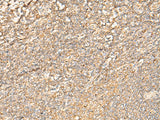 Immunohistochemistry of paraffin-embedded Human tonsil tissue using EIF3C Polyclonal Antibody at dilution of 1:35(×200)