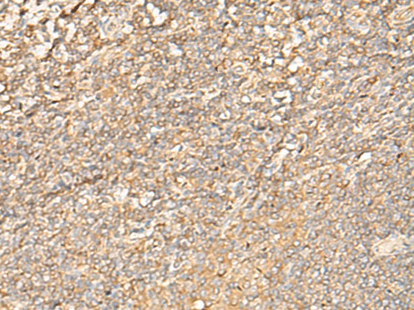 Immunohistochemistry of paraffin-embedded Human tonsil tissue using EIF3C Polyclonal Antibody at dilution of 1:35(×200)