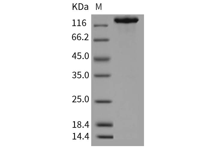 Recombinant Mouse CHL-1 Protein (Fc Tag) - ABMIUM