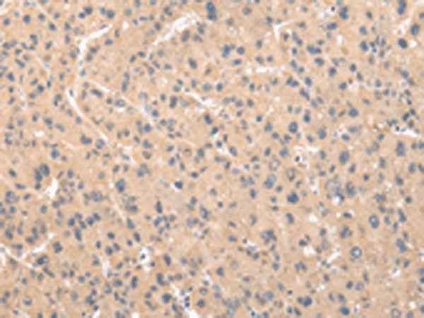 Anti-Human ZNF268 Antibody