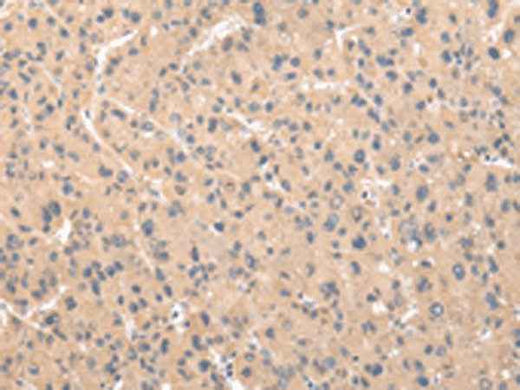 Anti-Human ZNF268 Antibody